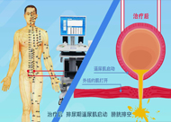 人和醫(yī)院 尿潴留、尿失禁動(dòng)畫